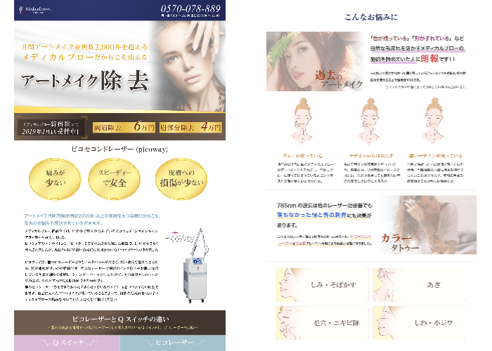 アートメイク・タトゥ―除去レーザー LP